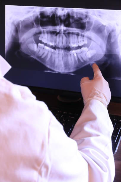 Best Knocked-Out Tooth (Avulsed Tooth) Treatment in Hagerstown, MD